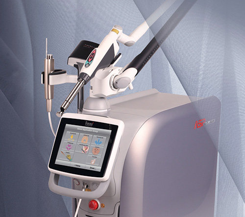 laser_ginecologia_evidenza